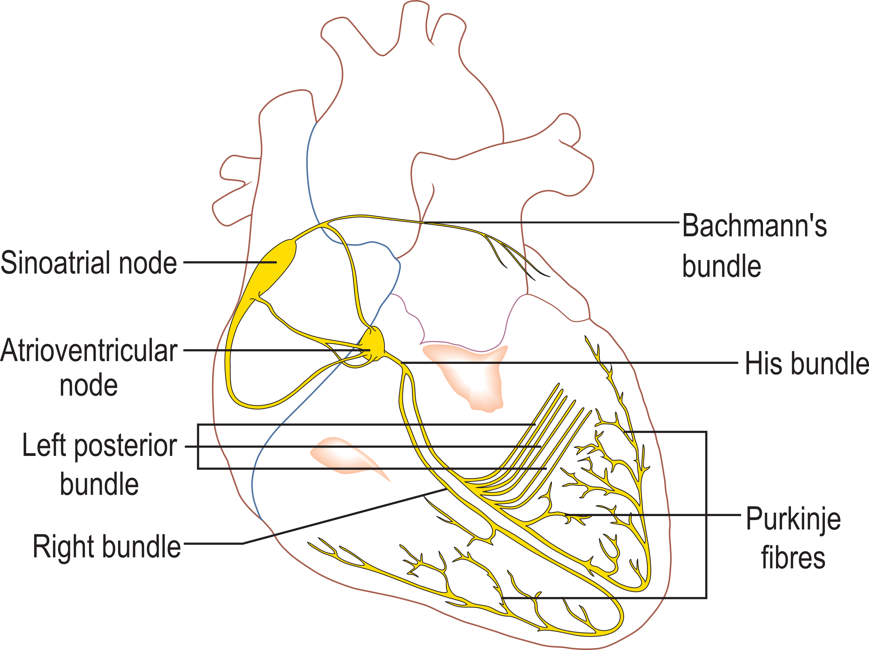 Figure 1: The conduction system of the human heart. The sinoatrial (or sinus) node, natural pacemaker of the heart, initiates a wave of action potentials that propagate sequentially and preferentially through specialised conductive structures (yellow) to reach every part of the heart muscle. (illustration by Madhero88, from Wikimedia commons, CC-By license)