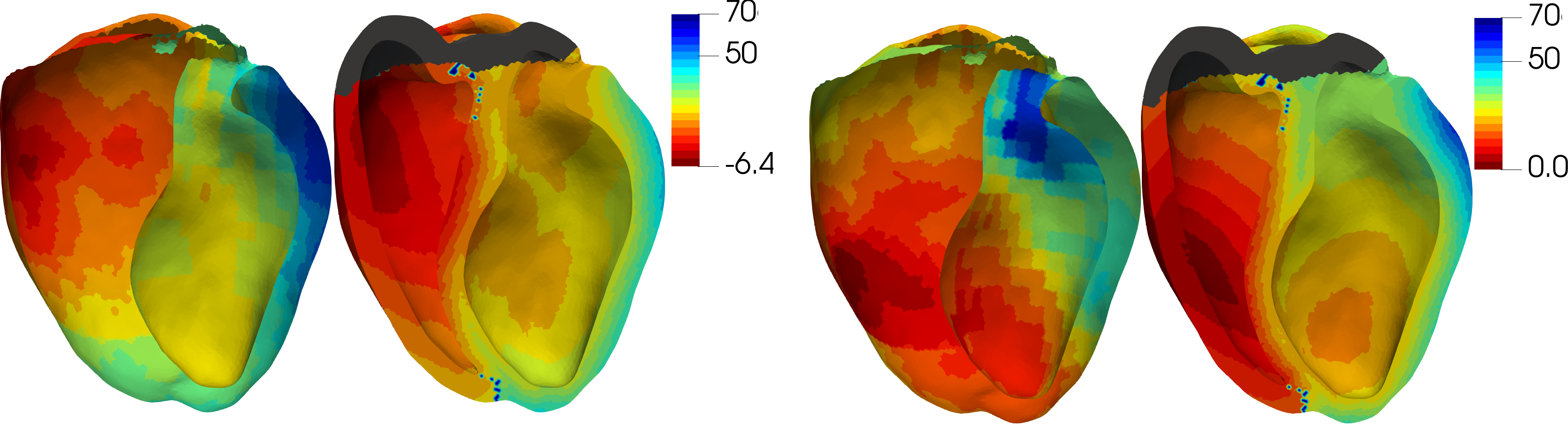 Figure 23: From left to right: recorded pre-CRT activation map, our model with fitted parameters, recorded post-CRT activation map, our model’s prediction. Colours indicate LATs in ms.