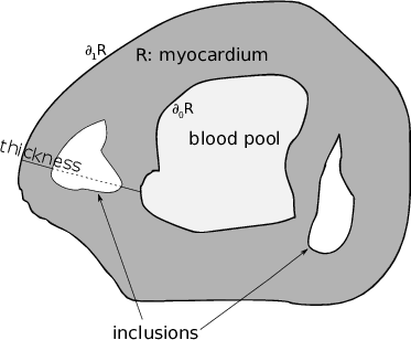 Figure 1: Illustration of the problem adressed by our method. We want to measure the thickness of R, excluding the thickness of the inclusions, ie the length of the thickness line, exclusing the dotted part. \partial_0 R: inner boundary. \partial_1 R: outer boundary.